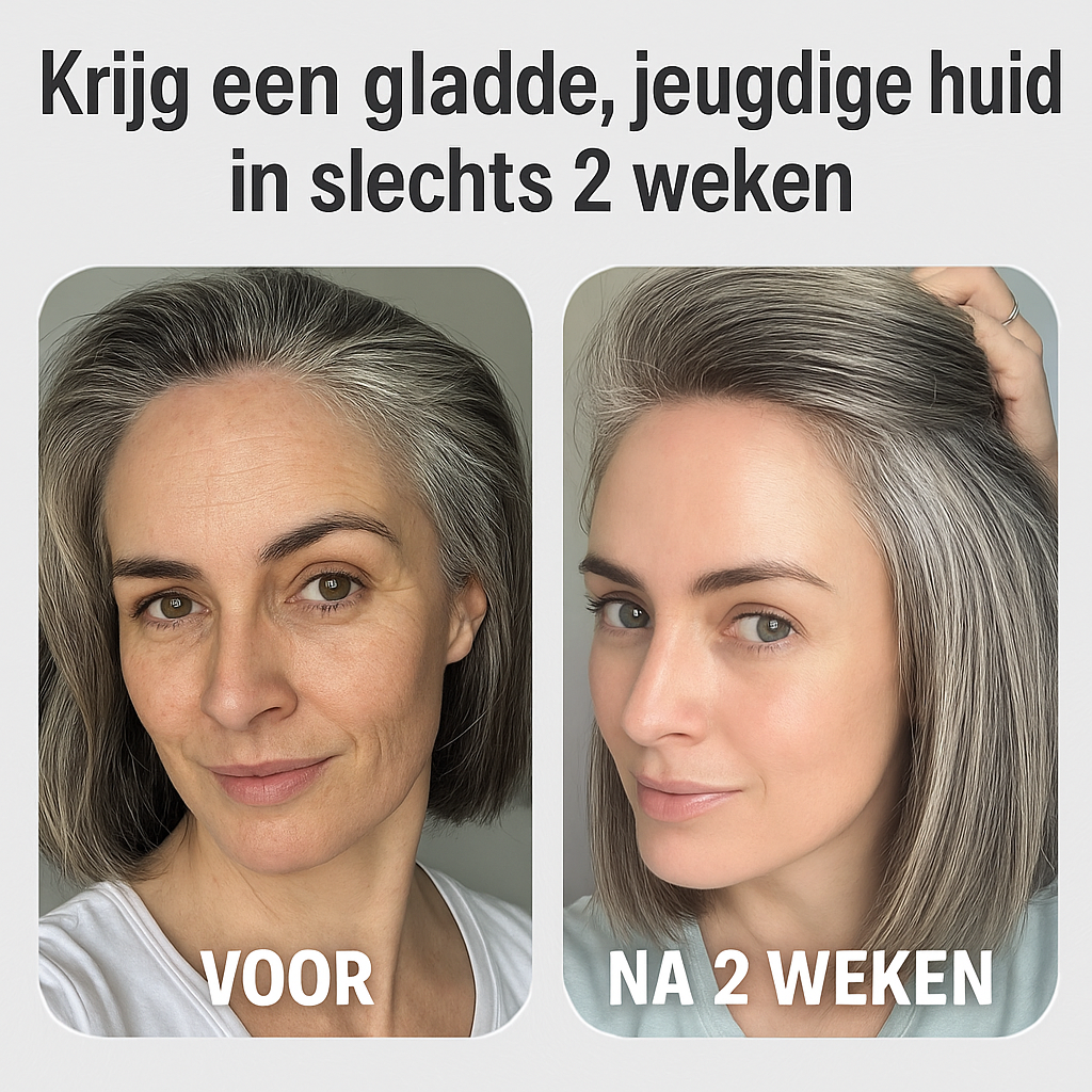 Derma Fusion Moderne huidverjonging zonder injecties of pijn