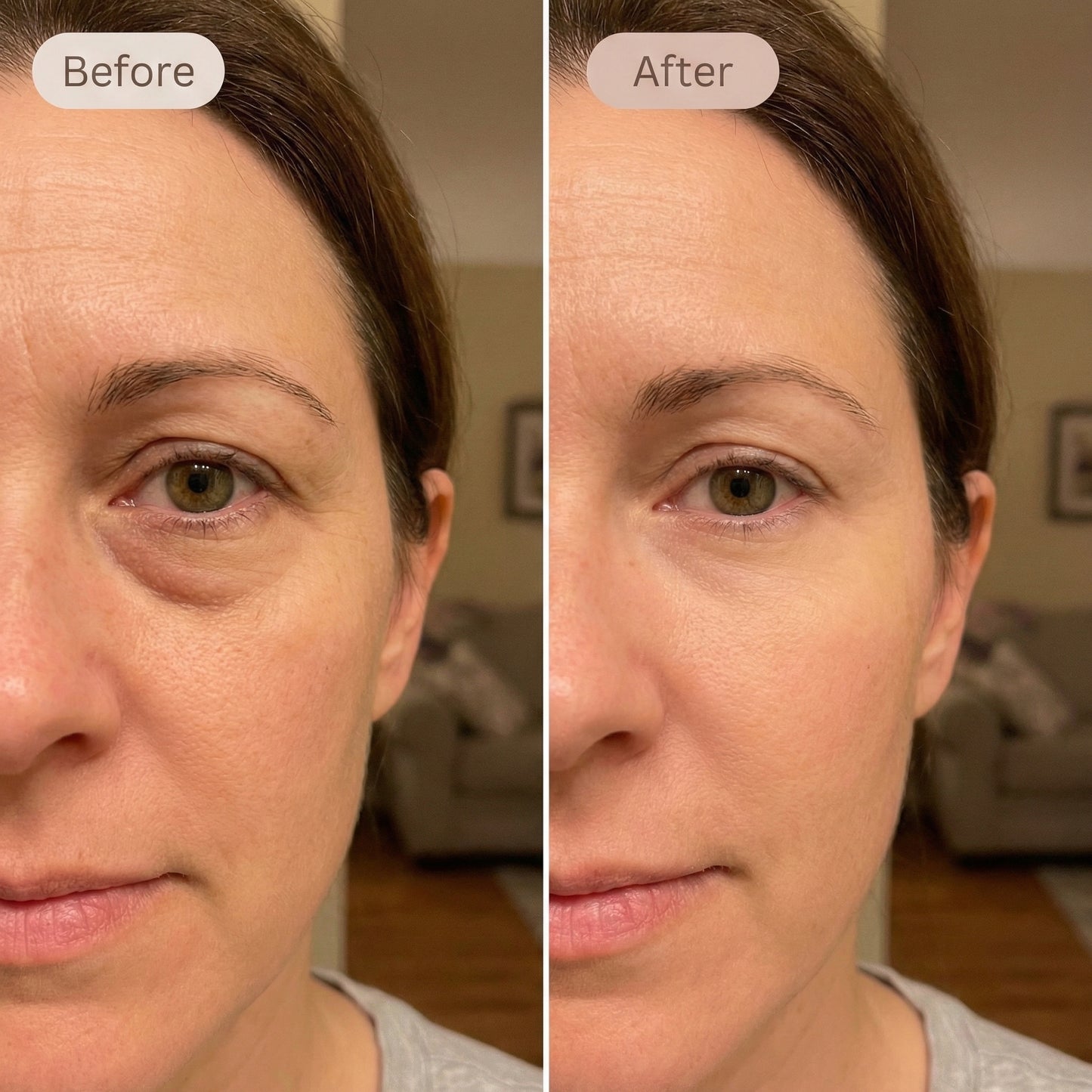 Mira Eye Recovery PRO