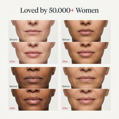 Plumpéra – Plump Without Needles