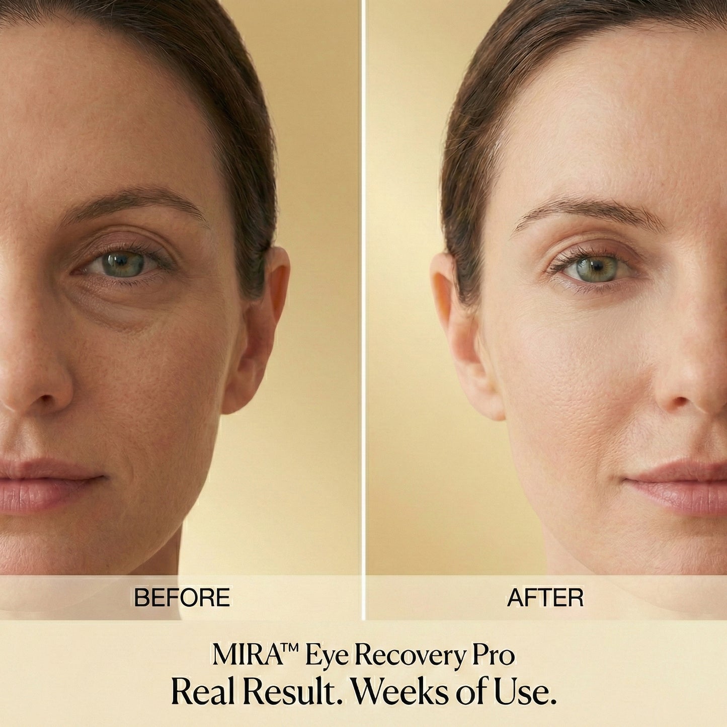 Mira Eye Recovery PRO