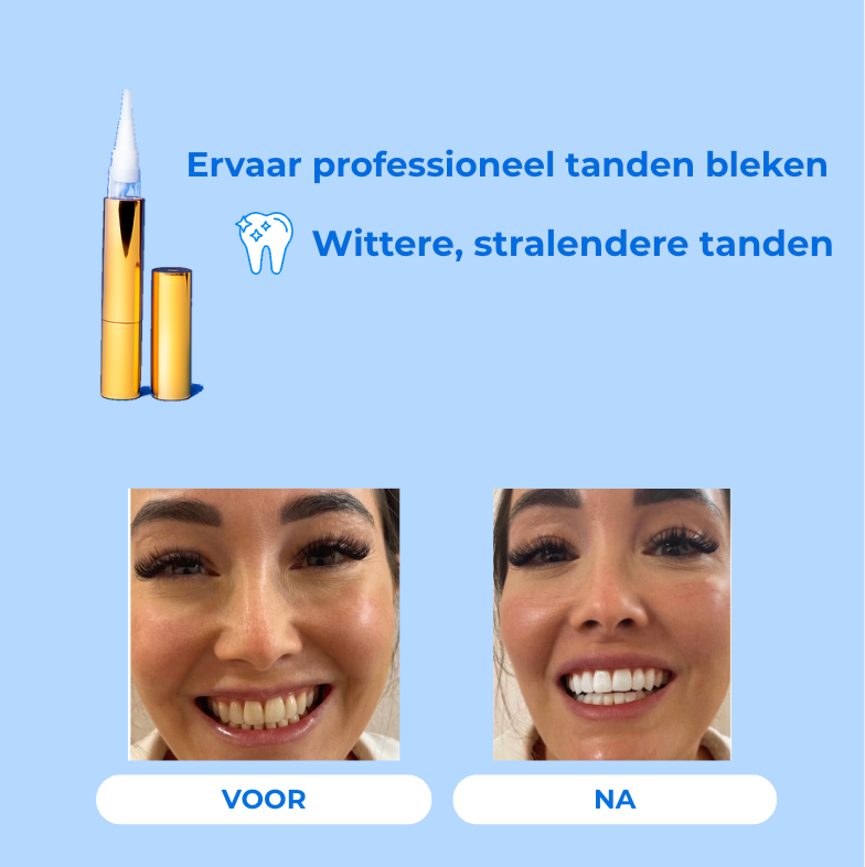 SmileLuxe Pen Klinisch Geïnspireerde Formule met Peroxide-Duo en Xylitol